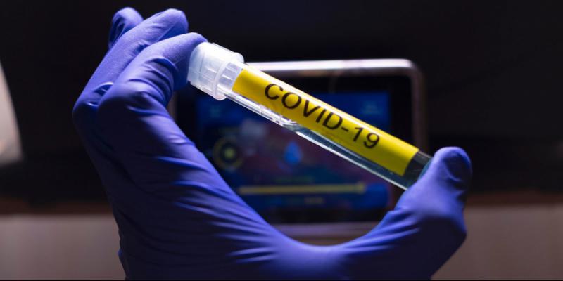 ÜST: COVID-19 koronavirusuna qarşı vaksin üçün 7-8 ən yaxşı namizəd var
